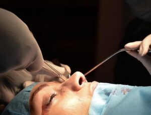 Burun estetiğinin hem mühendislik hem de heykeltıraş istikameti var